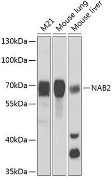 Anti-NAB2 Antibody (CAB5827)