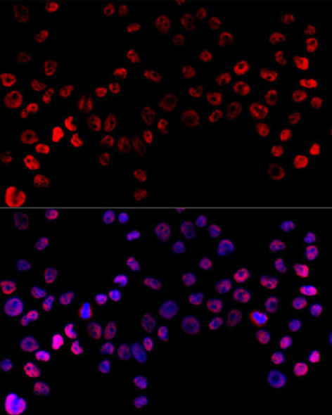 Anti-HNRNPH1 Antibody (CAB5924)