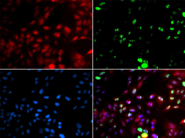 Anti-POLK Antibody (CAB6122)