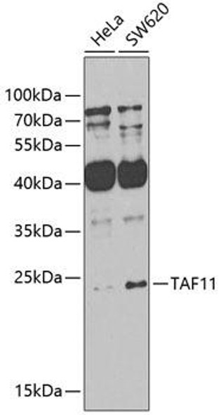 Anti-TAF11 Antibody (CAB7934)