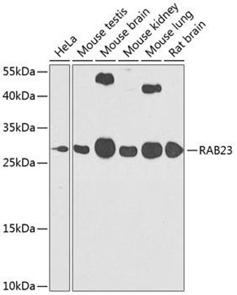Anti-RAB23 Antibody (CAB7979)