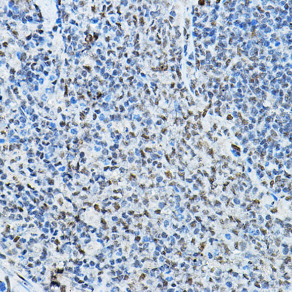 Anti-NCOR2 Antibody (CAB8388)