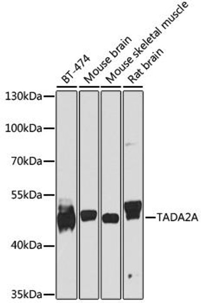 Anti-TADA2A Antibody (CAB8457)
