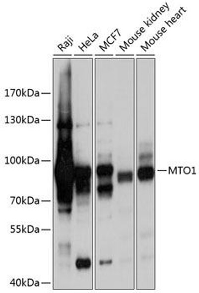 Anti-MTO1 Antibody (CAB9121)