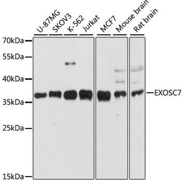 Anti-EXOSC7 Antibody (CAB9689)