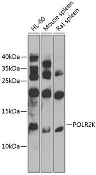 Anti-POLR2K Antibody (CAB9836)