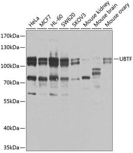 Anti-UBTF Antibody (CAB9847)