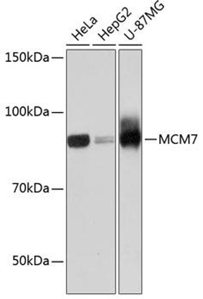 Anti-MCM7 Antibody (CAB11325)