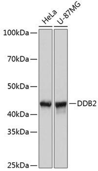Anti-DDB2 Antibody (CAB11615)
