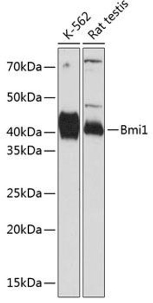 Anti-Bmi1 Antibody (CAB17914)