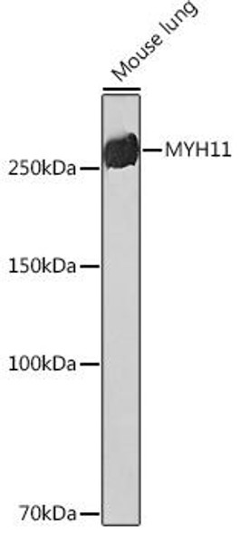 Anti-MYH11 Antibody (CAB4064)