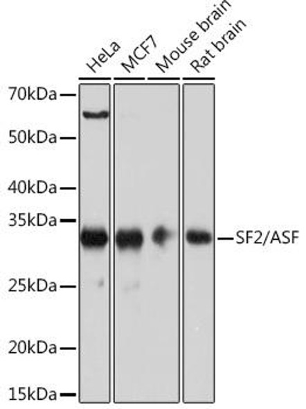 Anti-SF2/ASF Antibody (CAB4091)