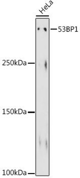 Anti-53BP1 Antibody (CAB3859)