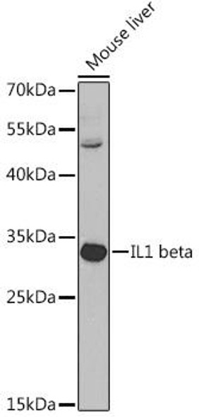 Anti-IL-1 beta Antibody (CAB1112)