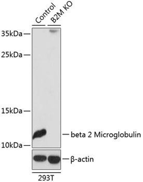 Anti-beta 2 Microglobulin Antibody (CAB12404)[KO Validated]