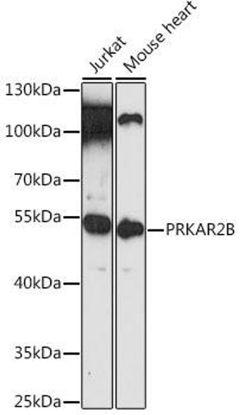 Anti-PRKAR2B Antibody (CAB12751)