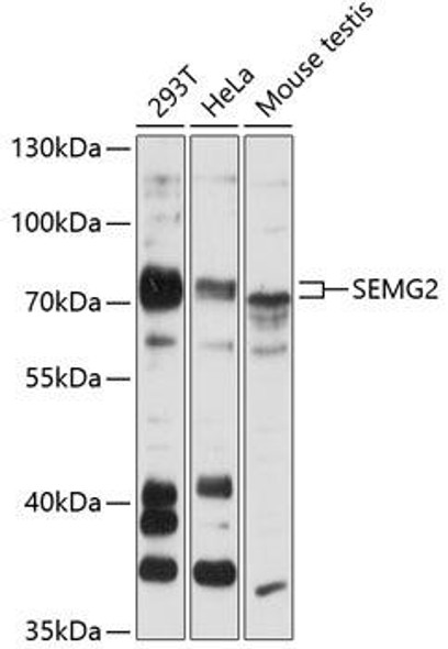 Anti-SEMG2 Antibody (CAB12826)