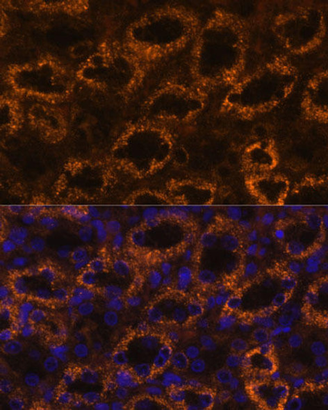 Anti-SLC7A9 Antibody (CAB12848)