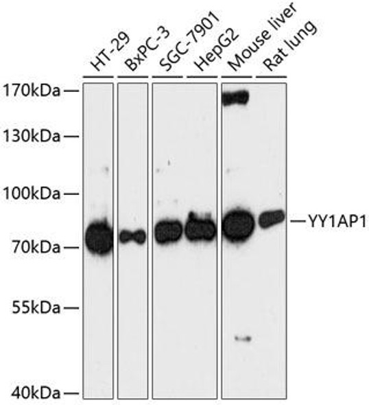 Anti-YY1AP1 Antibody (CAB13104)