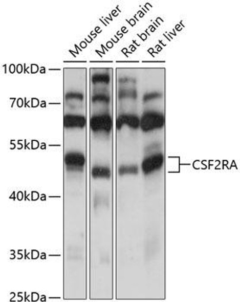 Anti-CSF2RA Antibody (CAB13181)