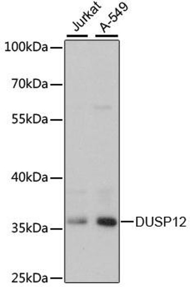 Anti-DUSP12 Antibody (CAB13247)