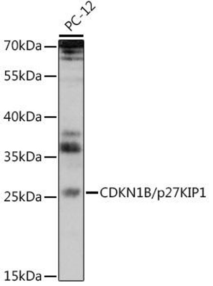 Anti-CDKN1B/p27KIP1 Antibody (CAB13613)