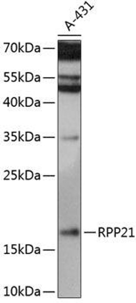 Anti-RPP21 Antibody (CAB14424)