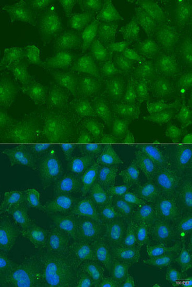 Anti-ZBTB20 Antibody (CAB15149)