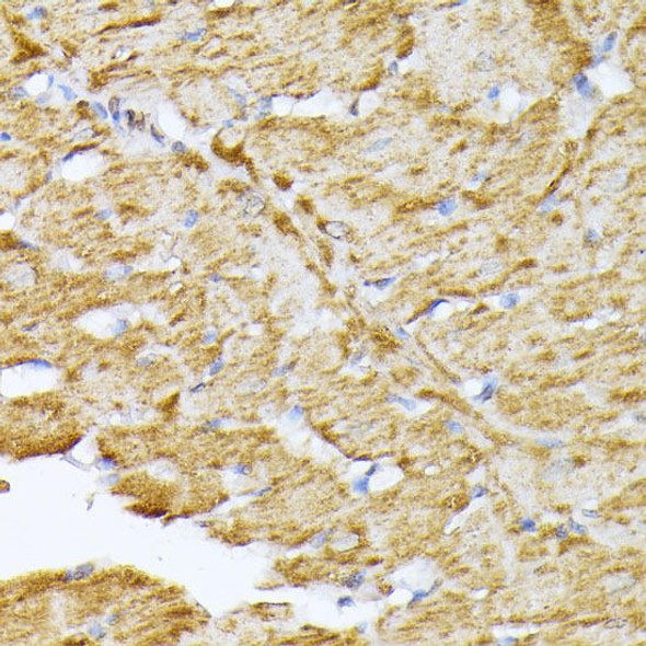 Anti-SLC25A5 Antibody (CAB15639)