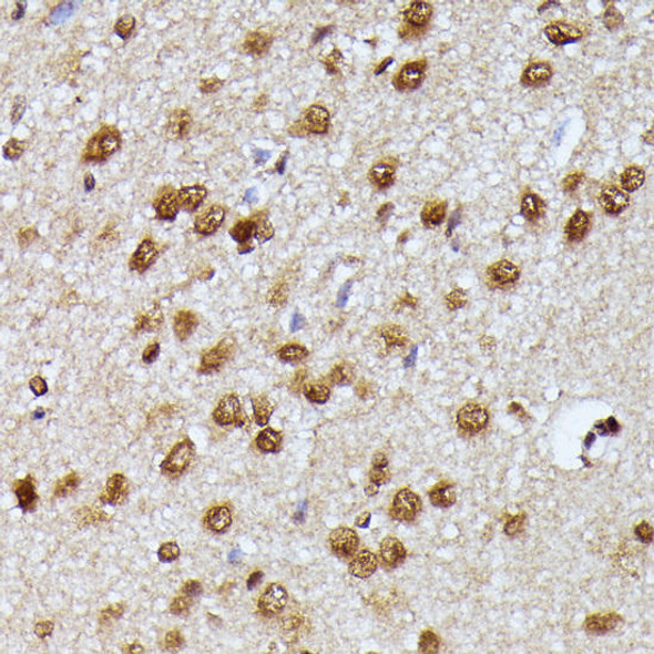 Anti-KIAA1429 Antibody (CAB16201)