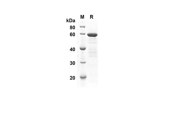 Recombinant Human MAPK3 Protein(Sumo Tag) (RPES8015)