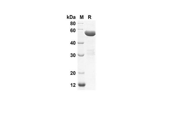 Recombinant Human LMNA Protein(Gst Tag) (RPES8034)