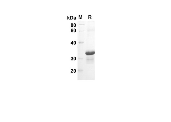Recombinant Human AREG Protein(Trx Tag) (RPES8041)