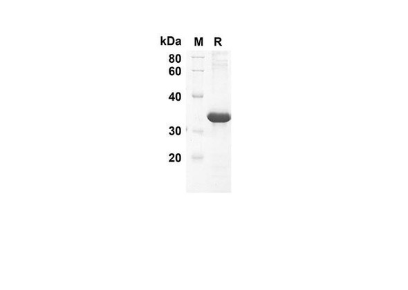 Recombinant Human CCL21 Protein(Trx Tag) (RPES8043)