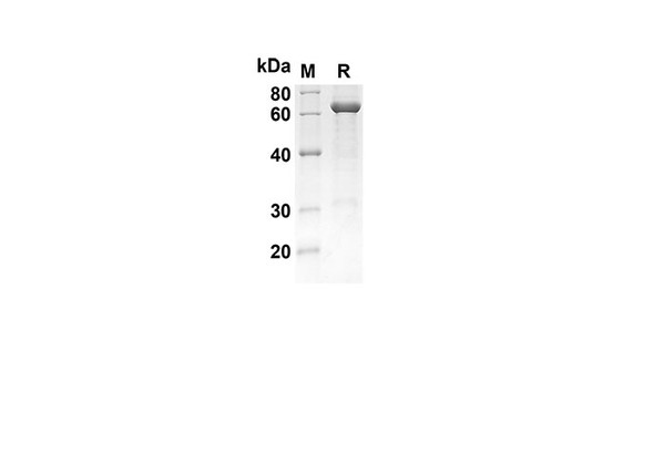 Recombinant Human HSPA1A Protein(Gst Tag) (RPES8056)