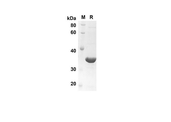 Recombinant Human FGF6 Protein(Trx Tag) (RPES8061)