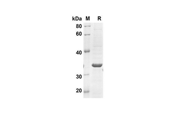 Recombinant Human LGALS7 Protein(Trx Tag) (RPES8063)
