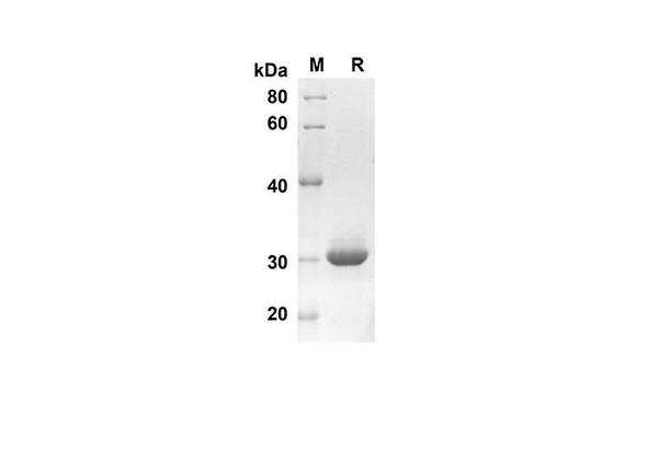 Recombinant Human S100A1 Protein(Trx Tag) (RPES8065)