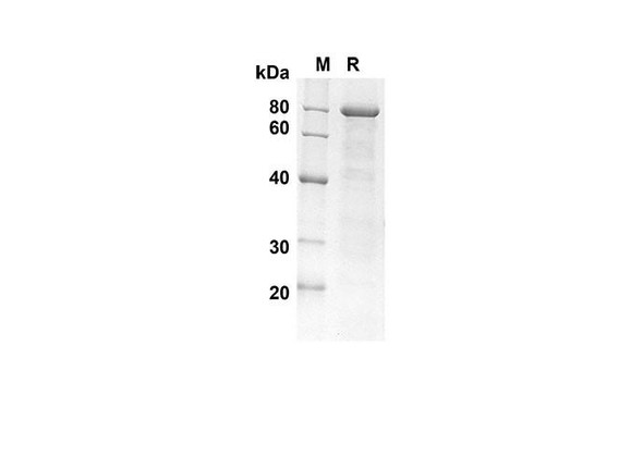 Recombinant Human PGFRA Protein(Trx Tag) (RPES8072)