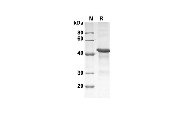 Recombinant Human DKK-4 Protein(Trx Tag) (RPES8073)