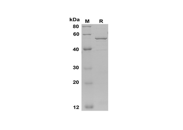 Recombinant Human HTRA1 Protein(Trx Tag) (RPES8084)