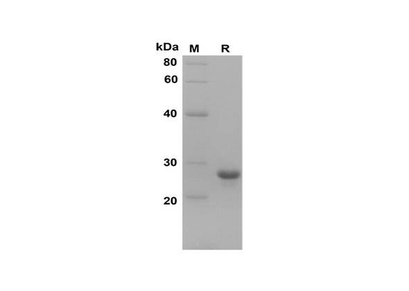 Recombinant Human PP Protein(Sumo Tag) (RPES8087)