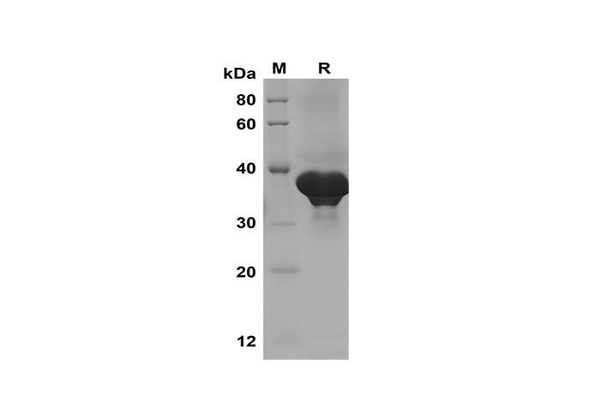 Recombinant Human PTHRP Protein(Trx Tag) (RPES8092)