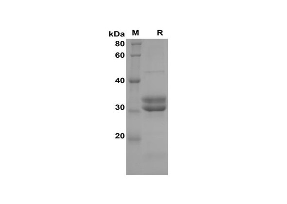 Recombinant Human IL-15 Protein(Sumo Tag) (RPES8098)