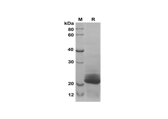 Recombinant Human Angiogenin Protein(Sumo Tag) (RPES8101)