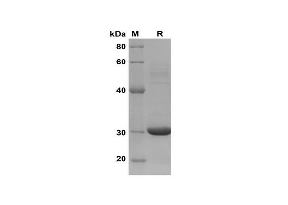 Recombinant Human CCL18/PARC Protein(Trx Tag) (RPES8114)