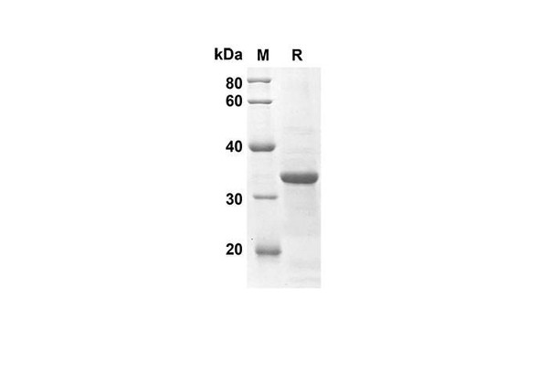Recombinant Mouse Ccl25 Protein(Sumo Tag) (RPES8151)