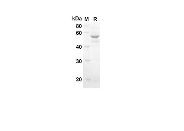 Recombinant Mouse SH3Y1 Protein(Sumo Tag) (RPES8161)