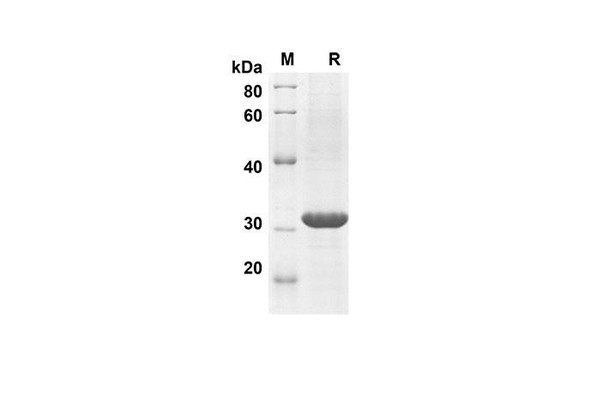 Recombinant Mouse CCL11 Protein(Trx Tag) (RPES8171)
