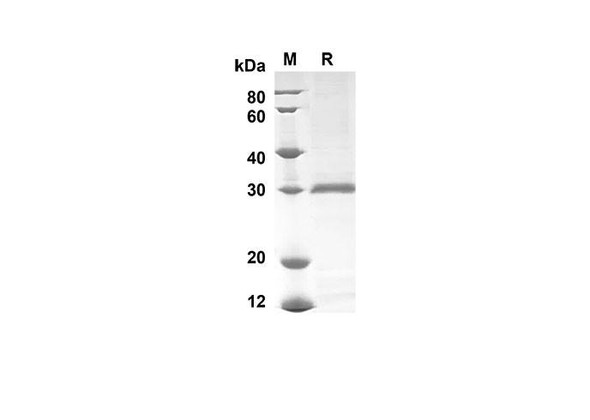 Recombinant Mouse Ly6g Protein(Sumo Tag) (RPES8173)